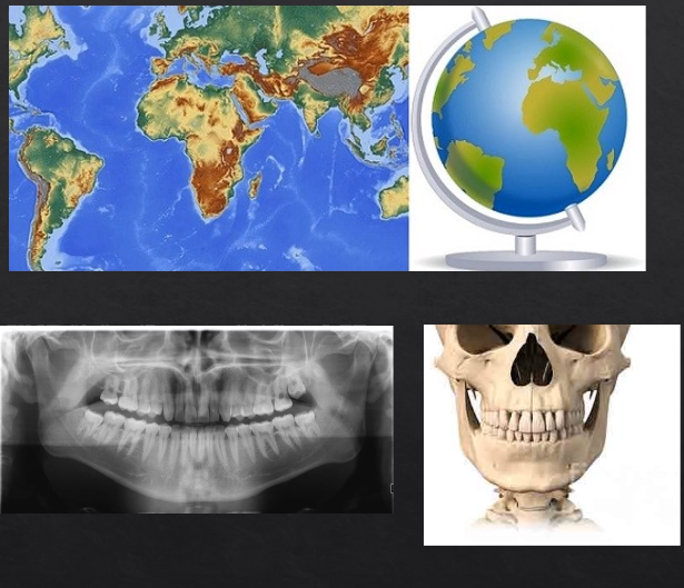 <p>each bit of the detector is being exposed but separately - like a printer - or like a panoramic photo → but this creates some <strong>geometric distortion </strong></p>