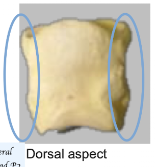 <p>Bony contours, named “ringbone” are noted </p><p>Function: Attachment collateral ligaments</p>