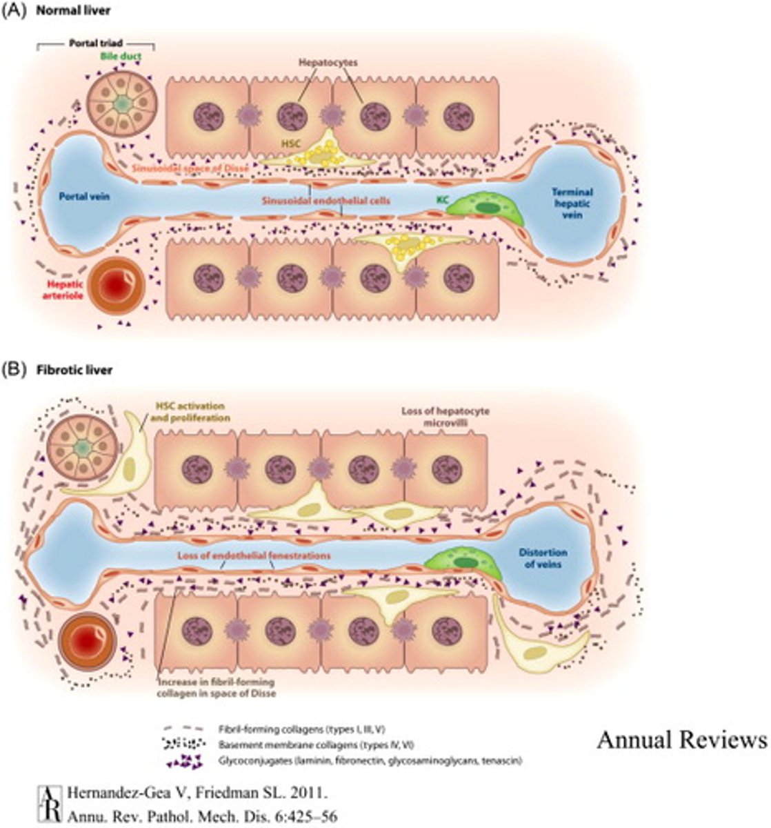 <p>also known as the space of Disse: </p><p>area between the endothelium that surrounds the liver sinusoids (sinusoidal endothelium) and hepatocytes where exchange of materials takes place.</p><p>ITS A SUBENDOTHELIAL SPACE </p>