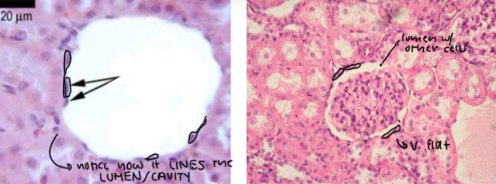 <ul><li><p>Characteristic: <strong>SINGLE LAYER of FLAT, PLATE-LIKE CELLS (</strong>looks like fishscales)</p></li><li><p>Location: <strong>ALVEOLI (AIR SACS) within LUNGS</strong> and <strong>WALLS OF CAPILLARIES and CAVITIES</strong></p></li><li><p>Function: <strong>EASY DIFFUSION; EFFICIENT EXCHANGES</strong> of materials and waste</p></li></ul><p></p><p>Key thing: these (epithelial cells in general) <strong>LINE the LUMEN (CAVITIES/SPACES)</strong></p><p></p>