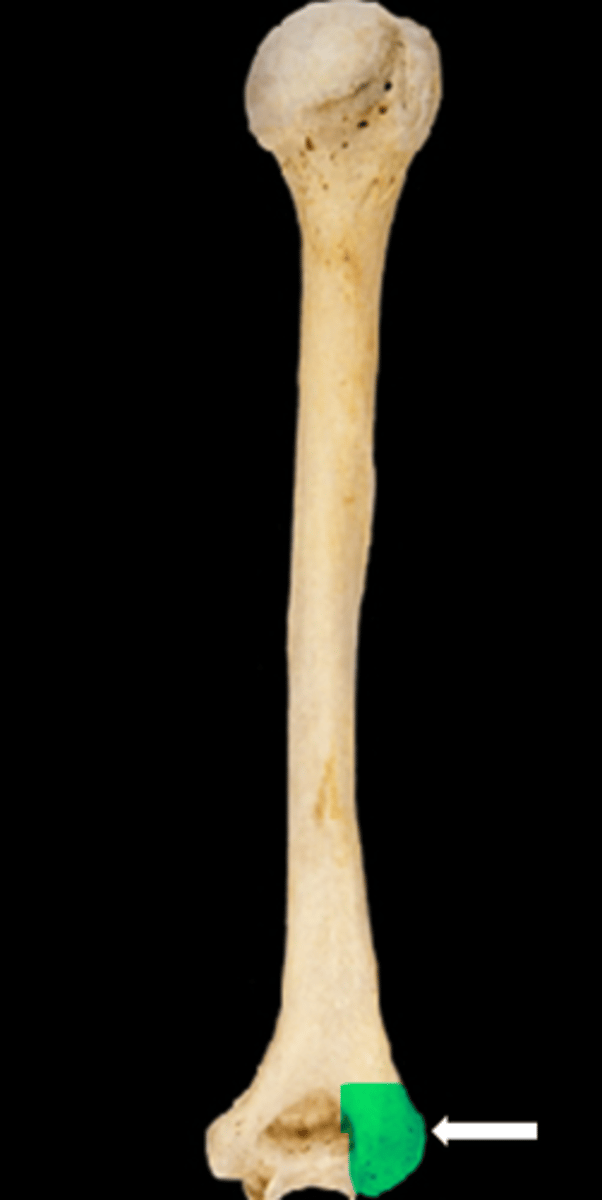 <p>name the part</p>