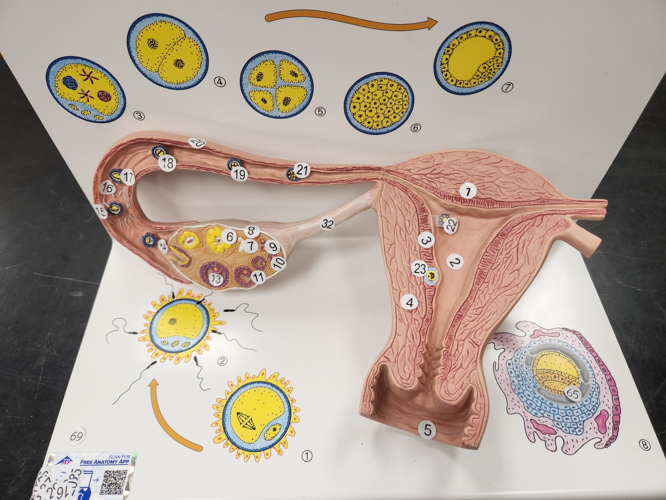 ampulla of fallopian tube

