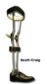 <p>Indication for the Craig-Scott KAFO? Advantages?</p>