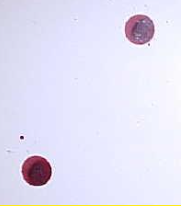 <p>Blood that drips off an object- example bloody knife, bloody nose</p>