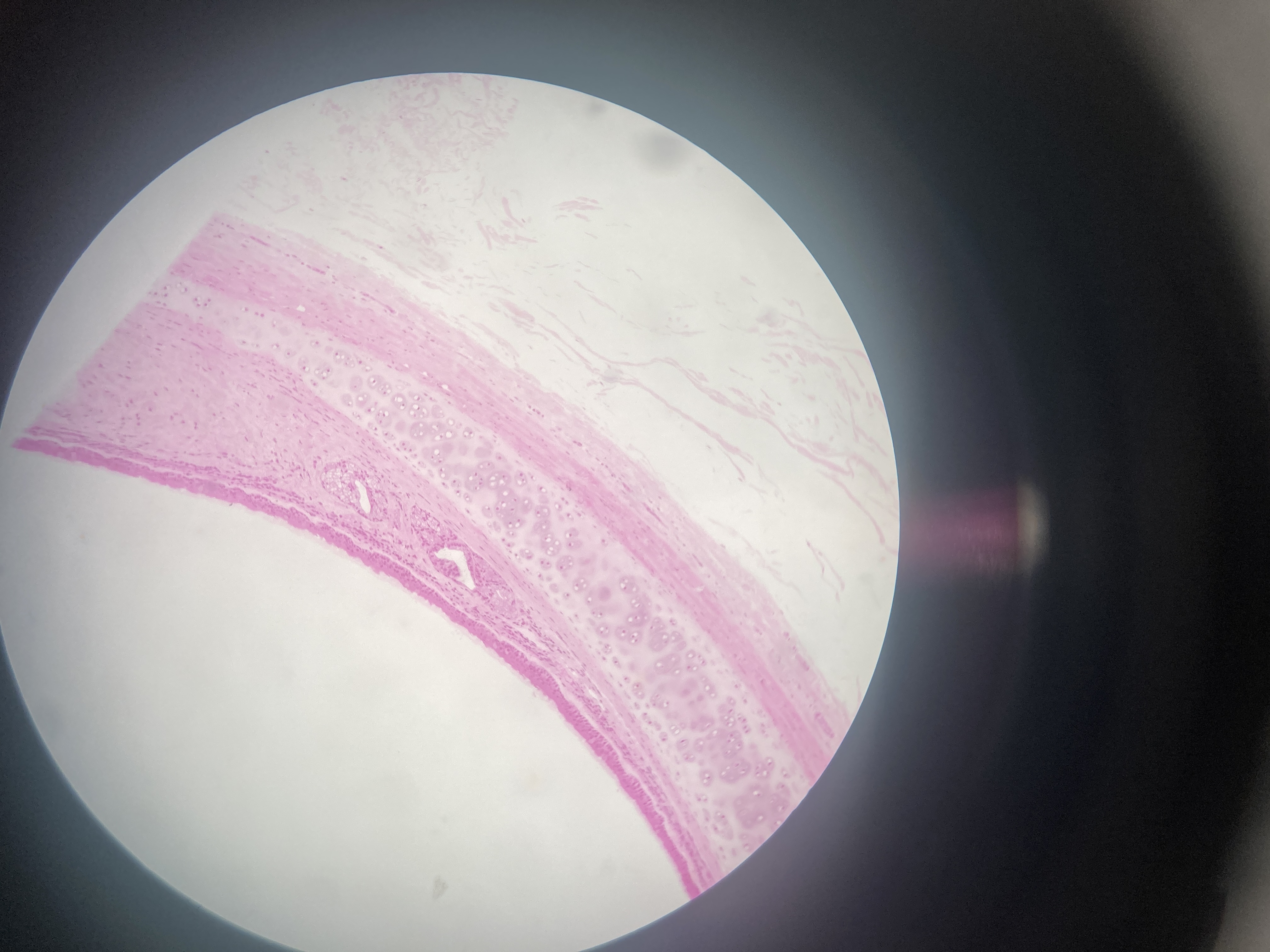 <p>Trachea (monkey)</p><p><span>Pseudostratified ciliated columnar epithelial</span></p><p><span>Goblet cells</span></p><p><span>Basal cells</span></p><p><span>Brush cells</span></p><p><span>Submucosal glands</span></p><p><span>Smooth muscle cells</span></p><p><span>Cartilage</span></p>