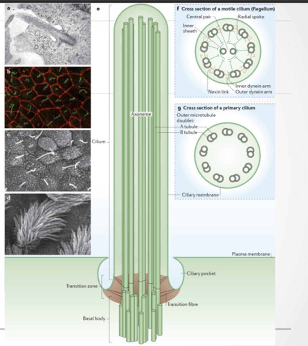 <p>Organelle made of membrane, cytosekelton, and motor proteins</p><p>9+2 arrangement :</p><p>9 outer doublets</p><p>2 central microtubules</p><p>Has dynein arms → movement - motile </p><p>9+0 arrangement - non-motile</p><p>Used for motion, environmental sensing, and other</p><p>No central pair</p><p>No proper dynein-driven motion</p><p>Mostly sensory (like antenna)</p><p>A cilium = tiny hair made of microtubules + motor proteins</p><p>MOVEMENT </p><p>Unattached microtubles will slide</p><p>Attached (has linking proteins) and microtubles will bend</p>