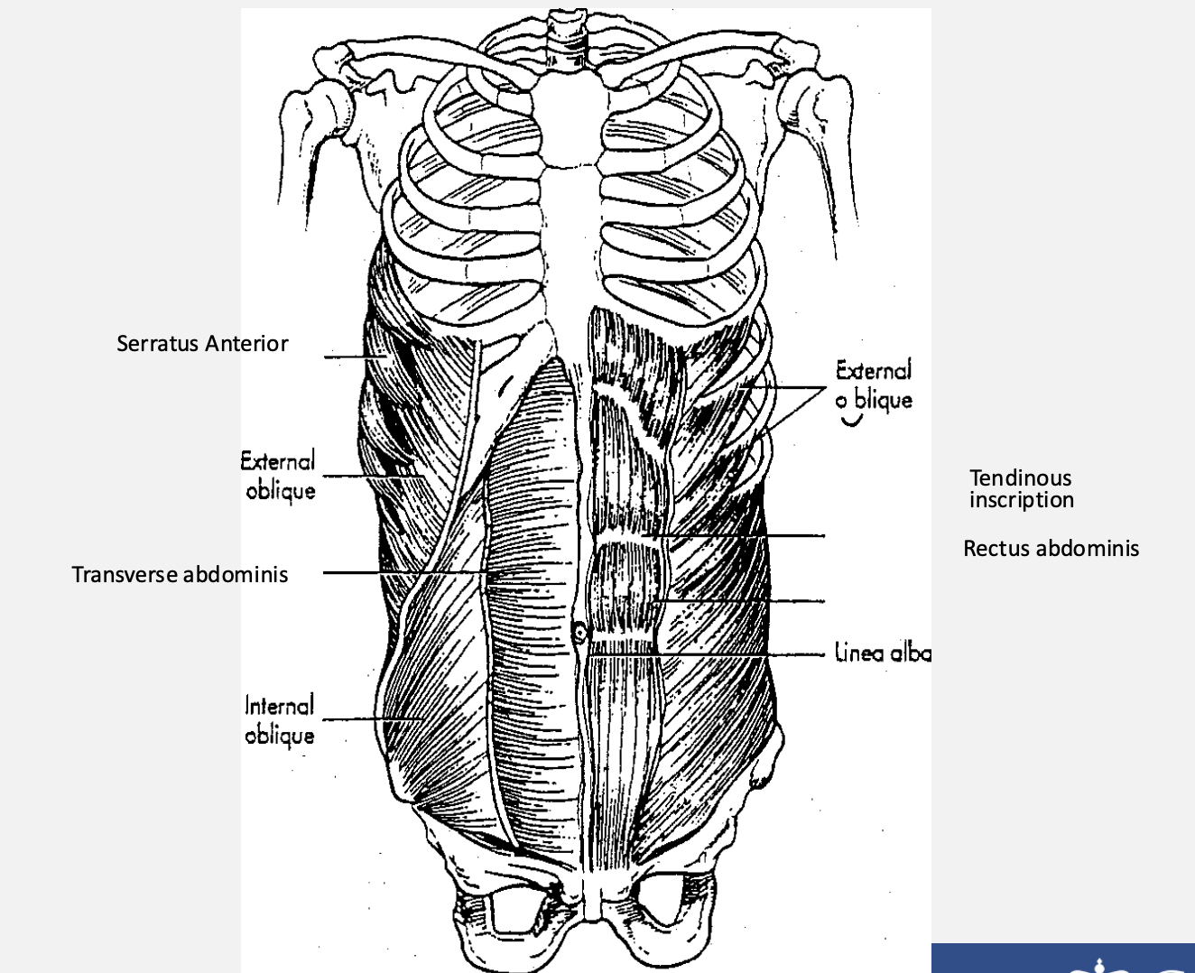 <ul><li><p>Purpose: </p><ul><li><p>1. Support Vital Organs </p></li><li><p>2. Respiratory assist </p></li><li><p>3. Trunk control</p></li></ul></li></ul><p></p>