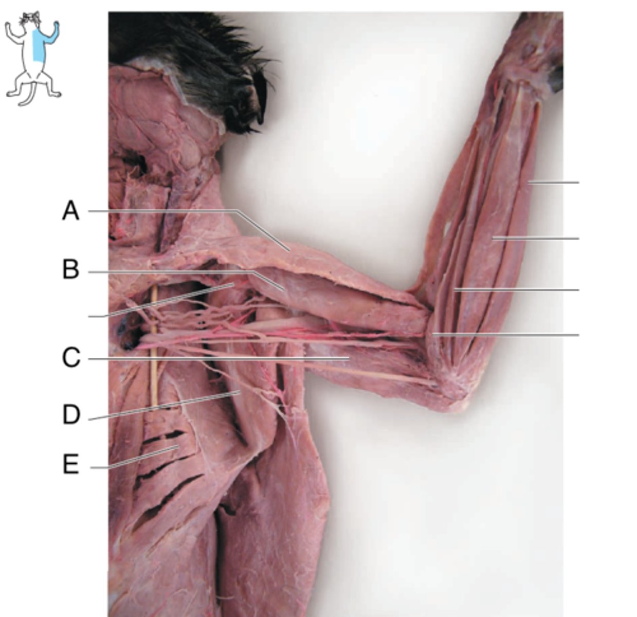<p>What is the muscle indicated by letter E? What is an attachment point and function?</p>