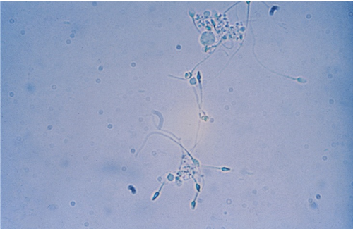 <p>oval, slightly taped heads, long flagella like tails and will rarely exhibit motility </p>