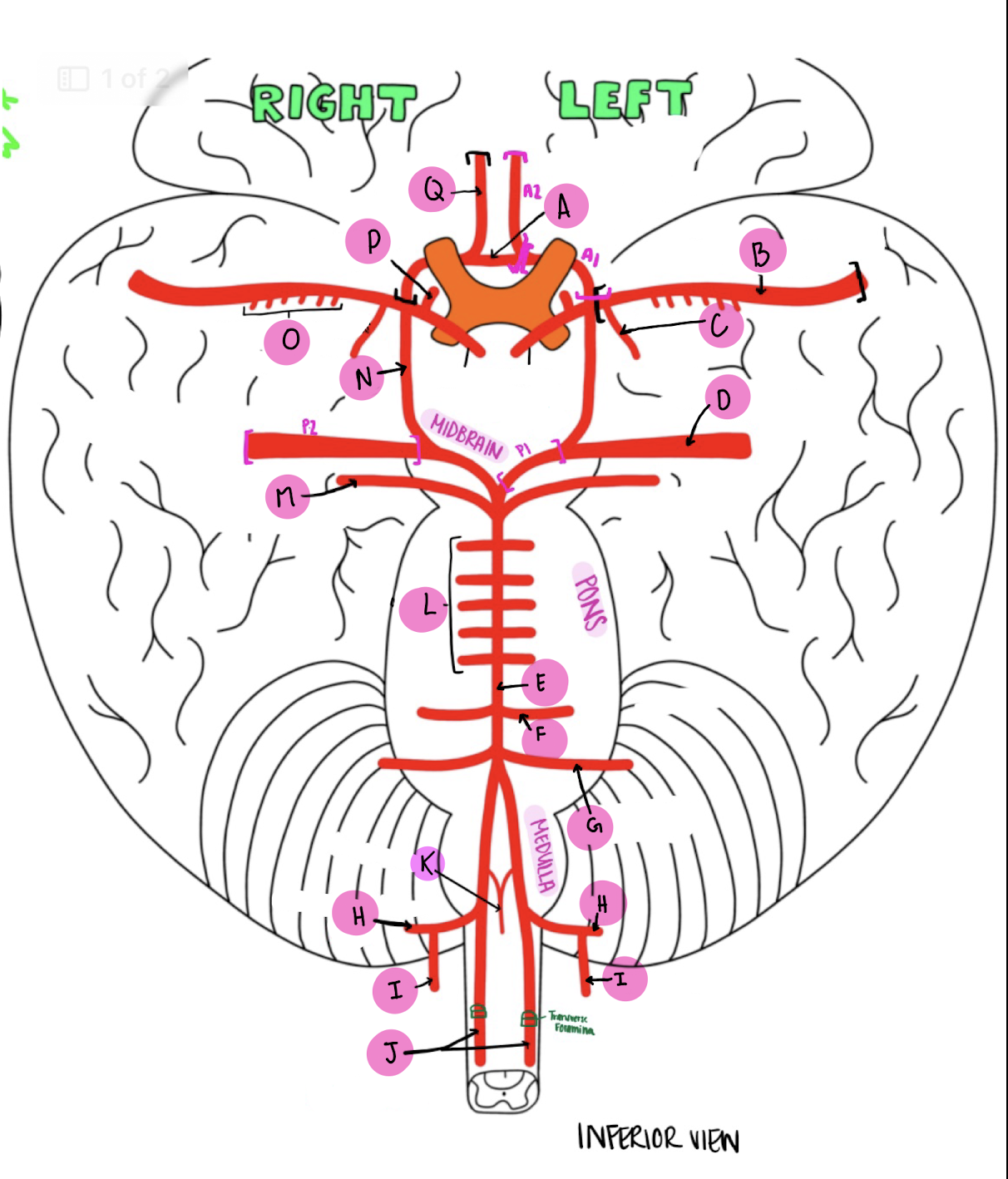 <p>What artery is labeled I?</p>