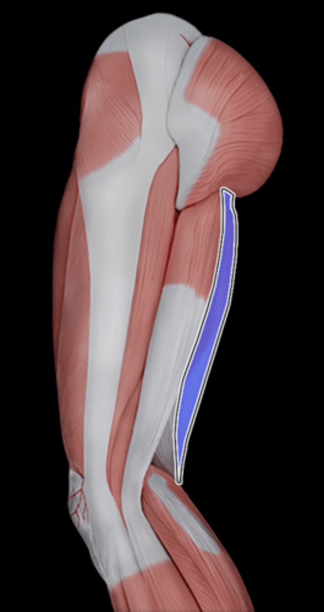 <p>What Muscle Is Highlighted?</p>