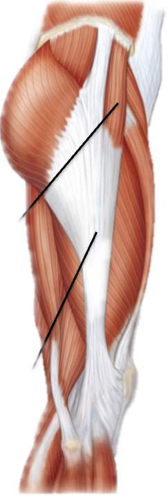 <p>What is the name of the connective tissue in this image?</p>