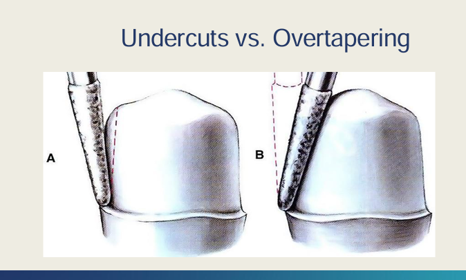 <p>Hold bur parallel</p><p>over-taper -  less retention and loss of tissue (buccal wall could expose the pulp in anterior and premolars)</p>