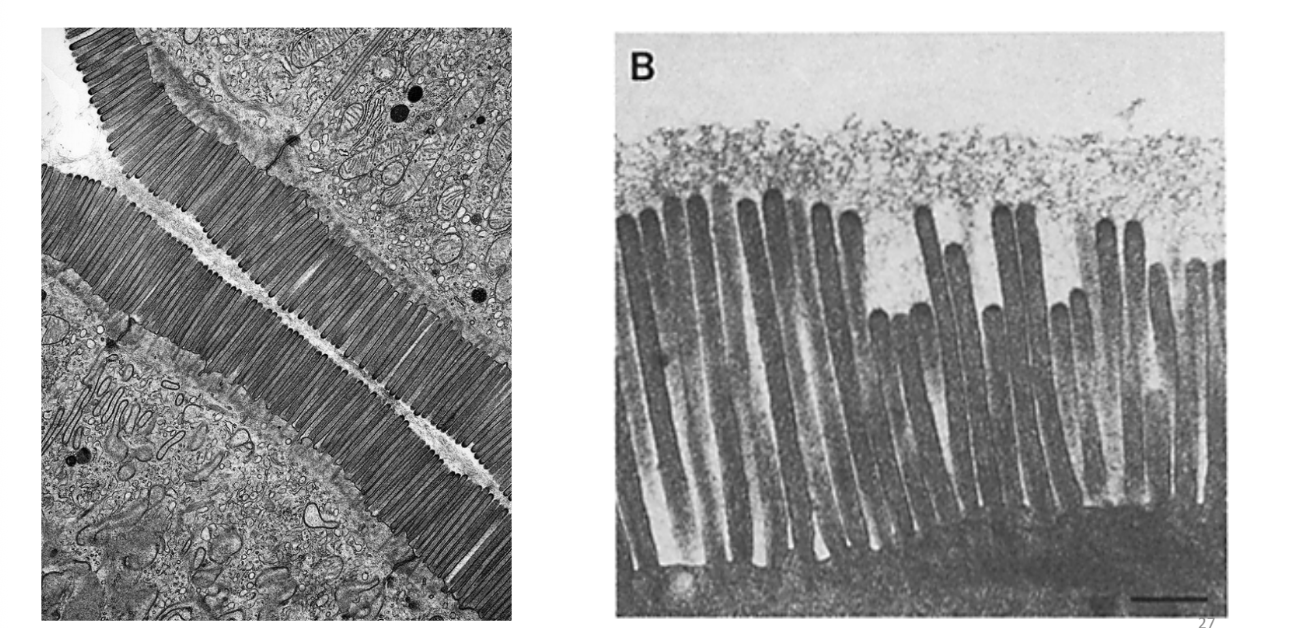 <p>even more absorptive surface area on each cell in the intestinal wall</p>