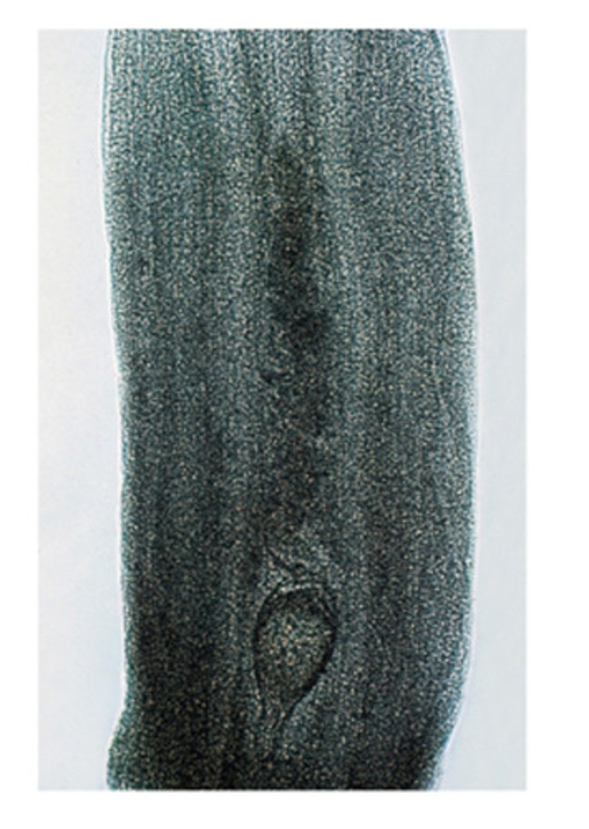 <p>Most tapeworms have similar appearing gravid proglottids, however, this tapeworm genus has unique appearing gravid proglottids. What tapeworm genus is this?</p>