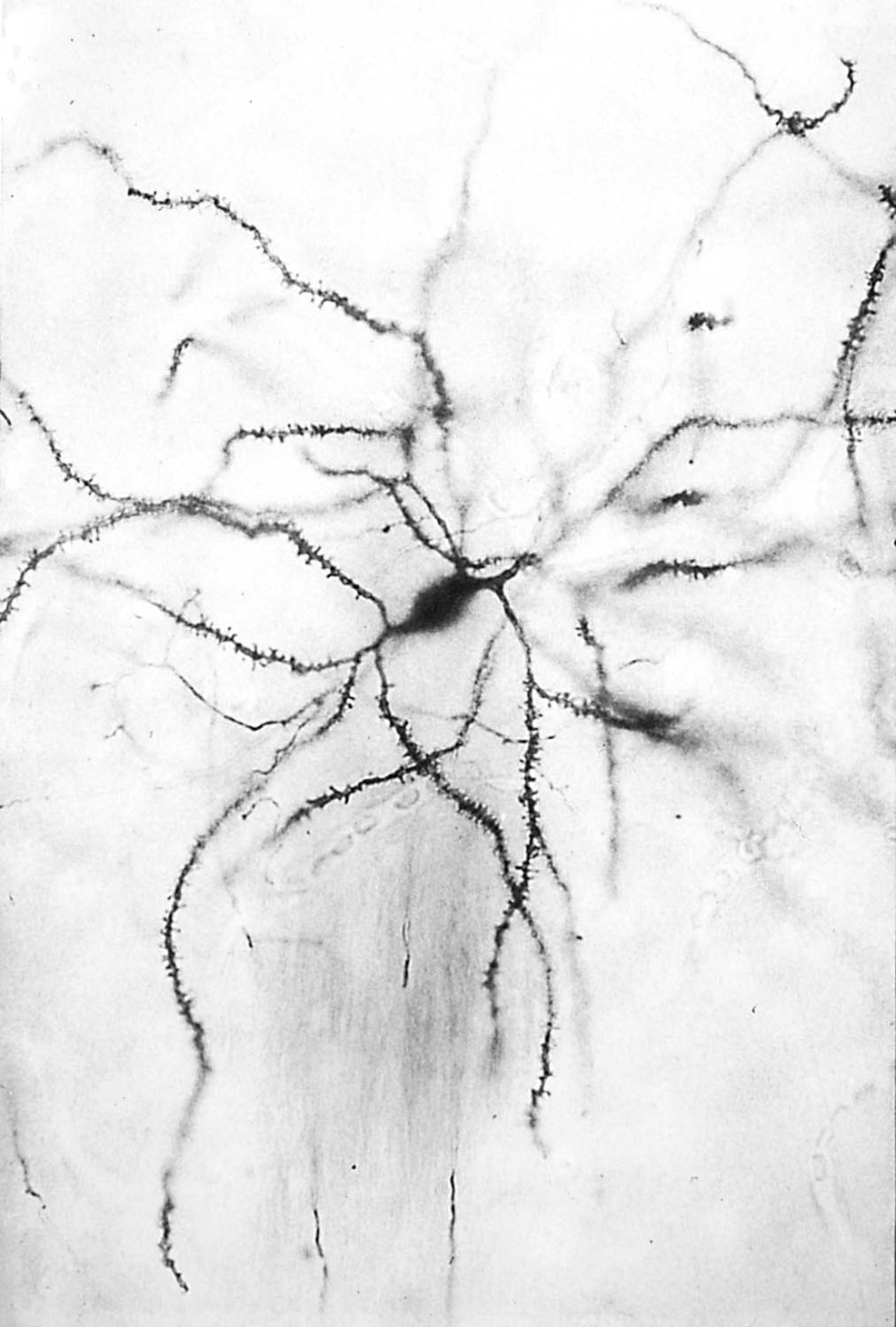<p>medium spiny neurons represent the main computational unit in the striatum and accumbens</p>
