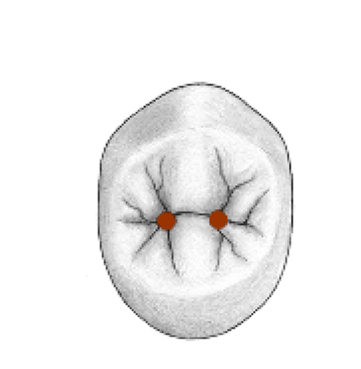 <p>shallow depression in bone</p>