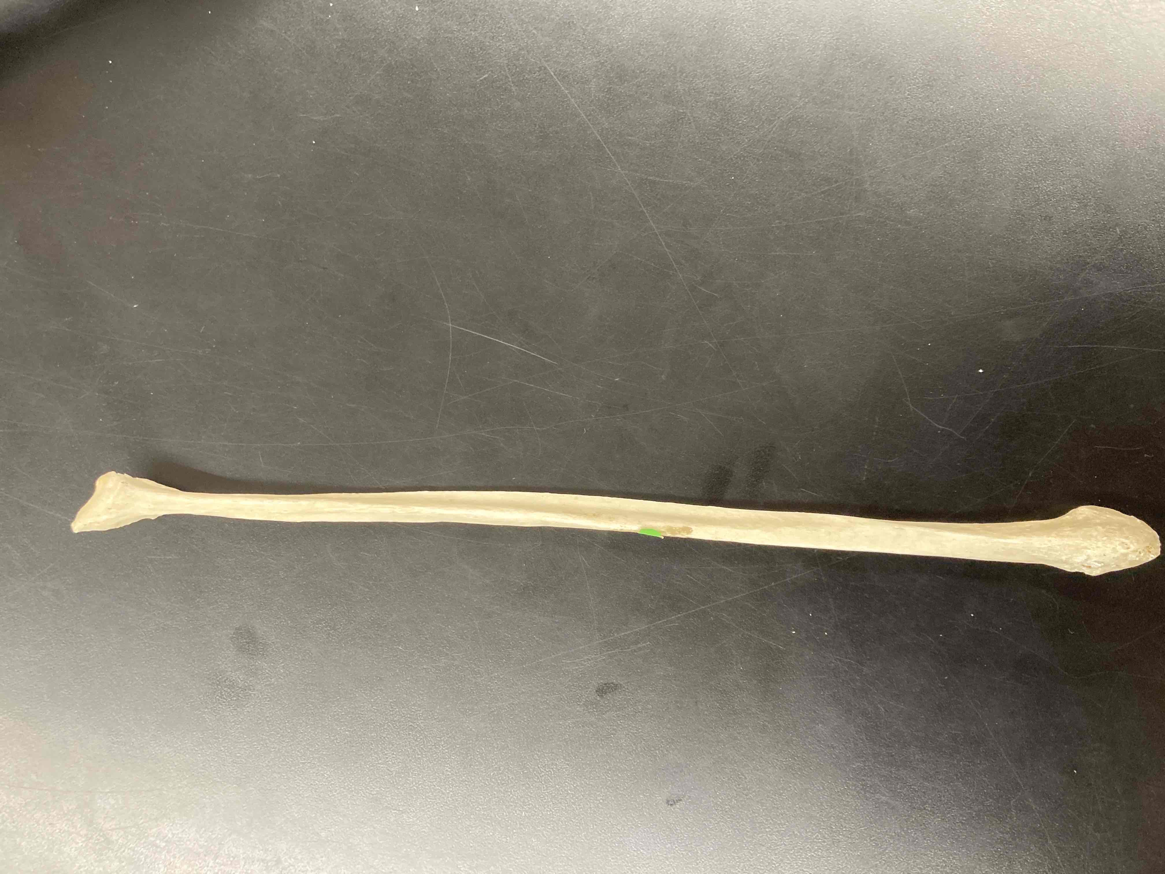 <p>What is the name of this bone?</p>