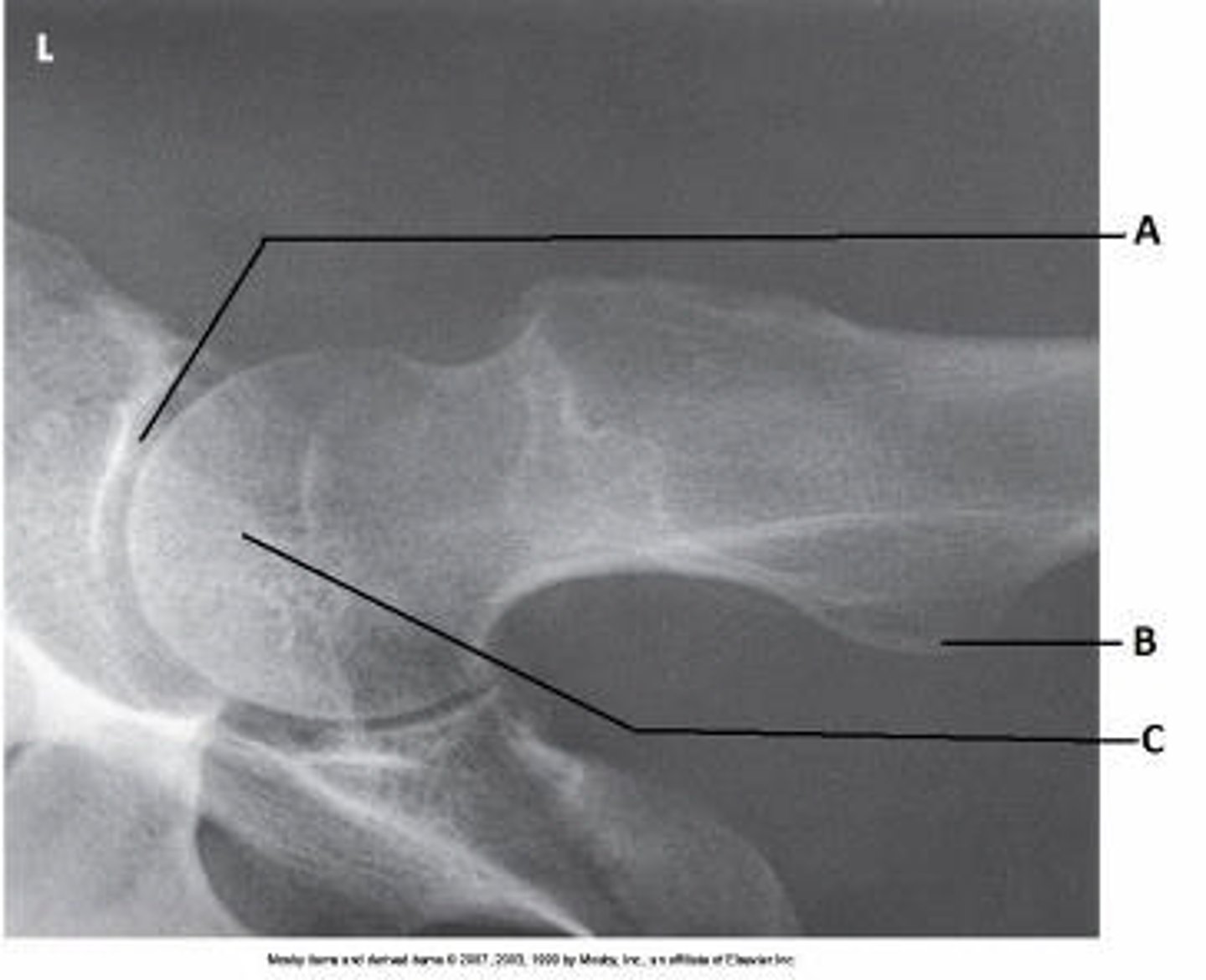 <p>What anatomy is labeled as letter A in the image below?</p>