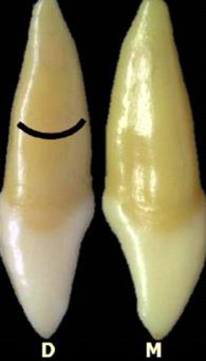 <p>what tooth is this?</p>