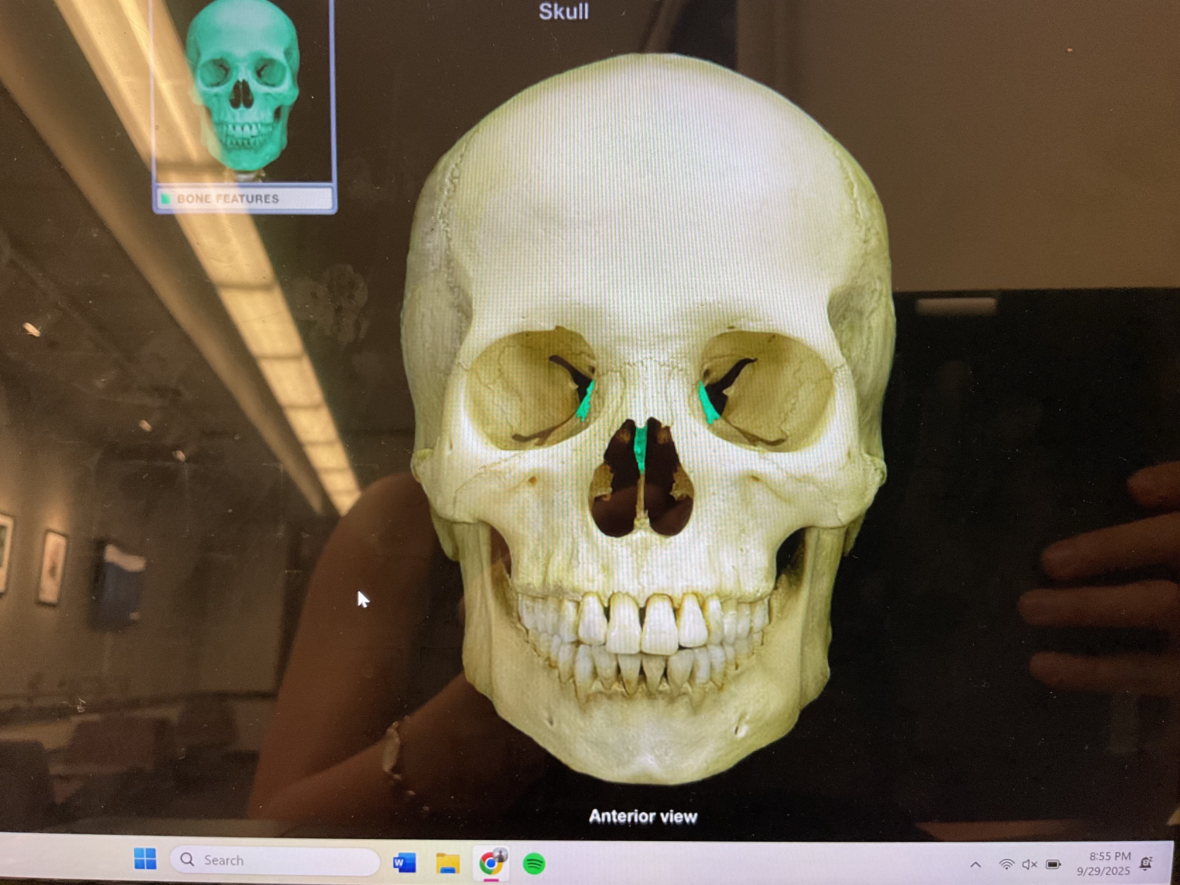<p>Ethmoid bone </p>