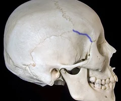 <p>Right Lateral View</p>