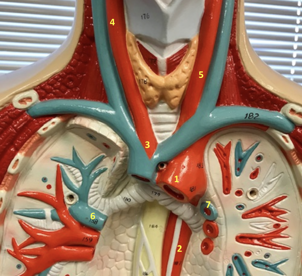 <p>Identify blood vessel 1</p>