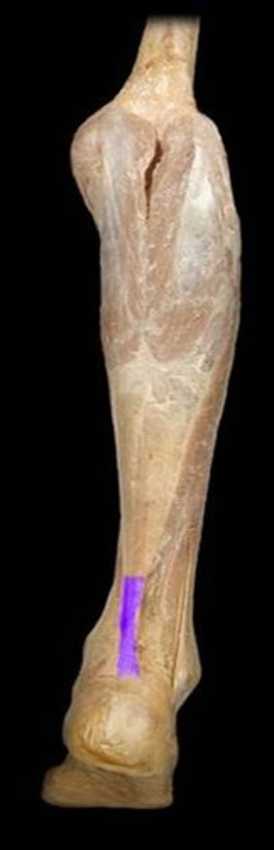 <p>Identify the connective tissue highlighted. Note: this is also known as the Achilles Tendon.</p>