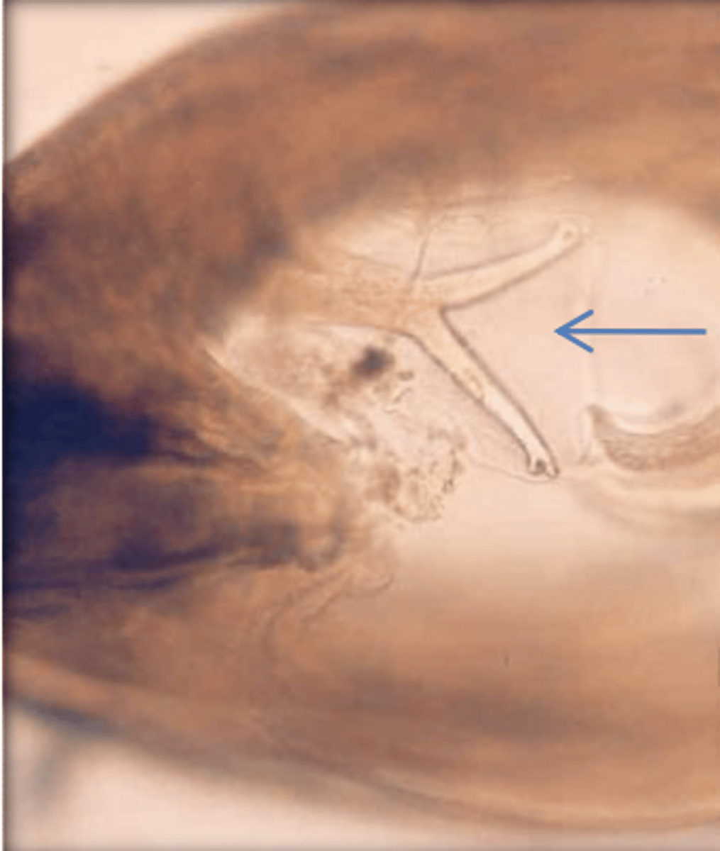 <p>What is this parasite? What characteristic/s did you use to identify it?</p>