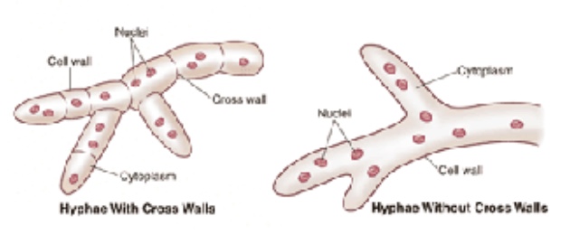 <p>What is septate and and aseptate in mold</p>