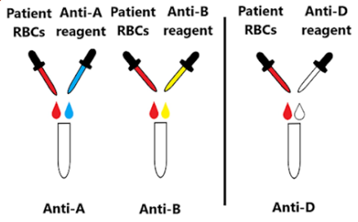 ABO Blood Grouping Flashcards Knowt