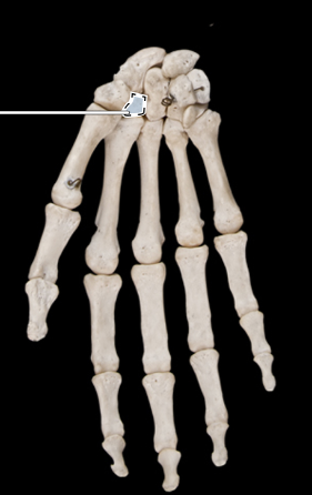 <p>Bones of the hand, anterior view, right side</p>