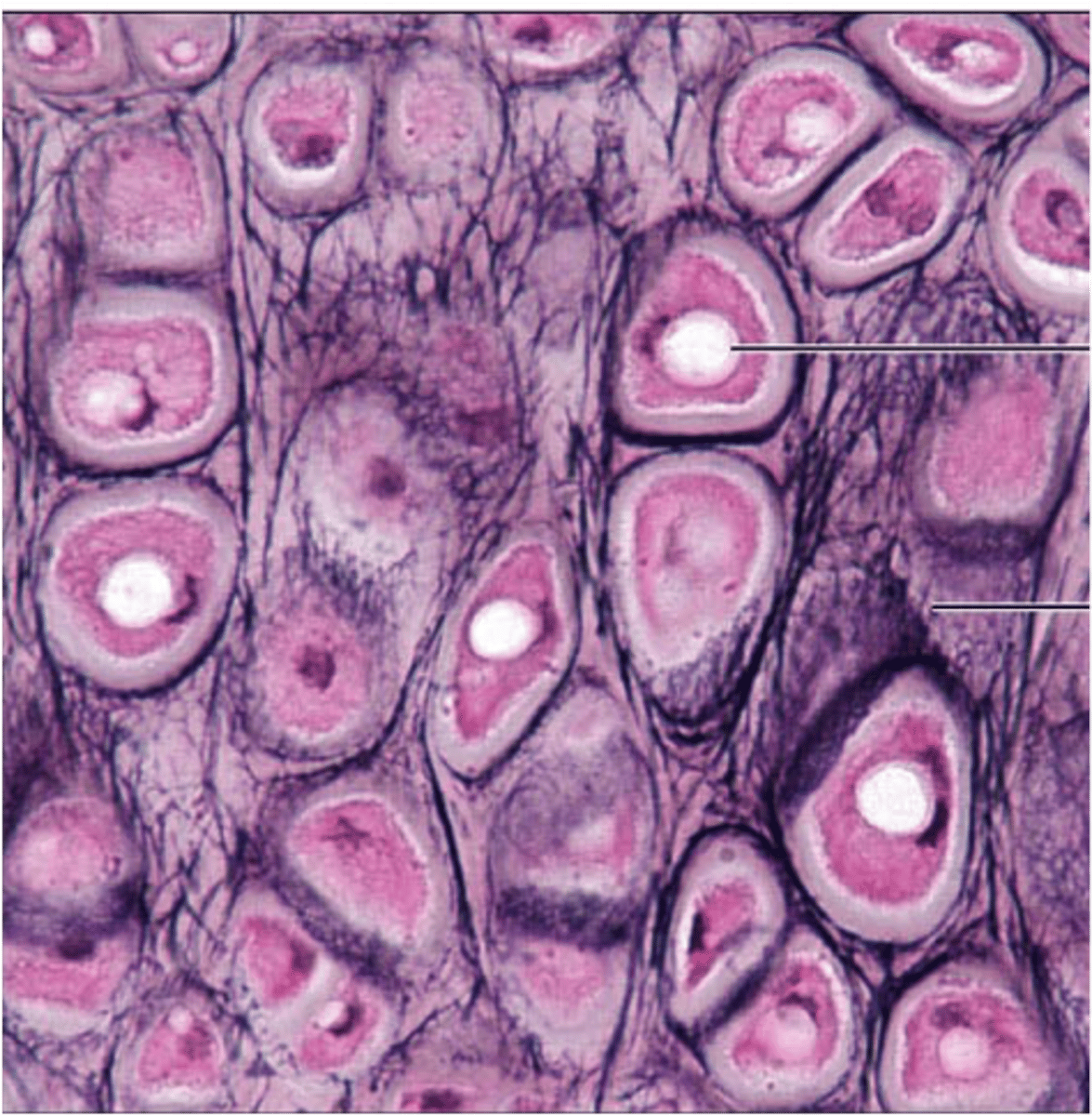 <p>cartilage with abundant elastic fibers; more flexible than hyaline cartilage due to presence of elastic fibers; found in epiglottis and external ear</p>