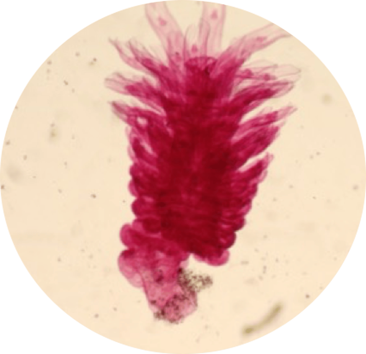 <p>Strobila</p><p>(contains many immature medusae</p>