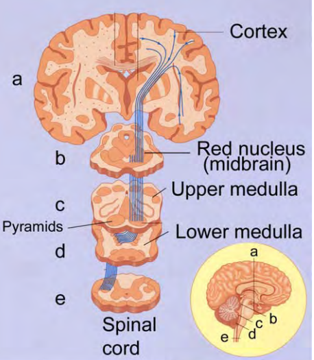 <p>In Figure 13.14a, why are some areas colored more lightly than others?</p>