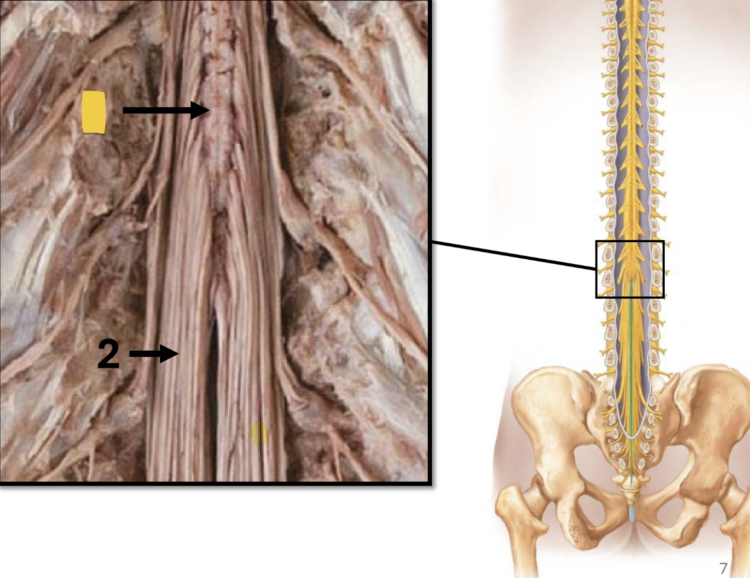 <ul><li><p>tapered, cone-shaped</p></li><li><p>distal portion of spinal cord</p></li></ul><p></p>