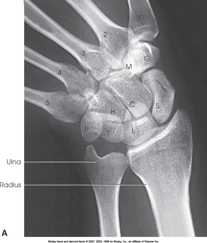 <p>What position is demonstrated?</p>