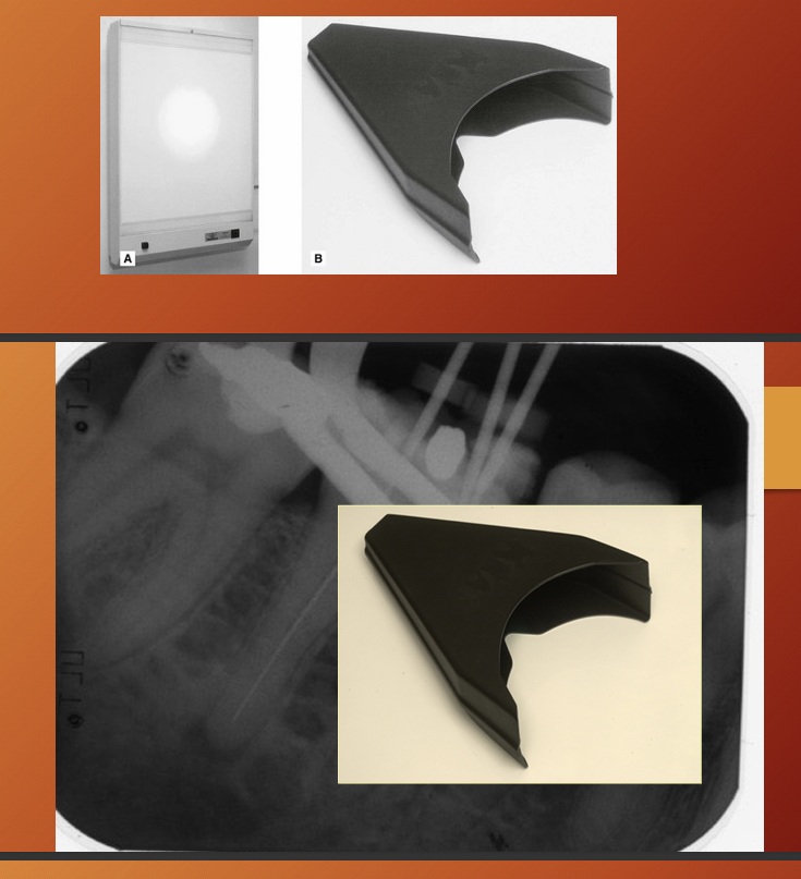 <p>Warday viewing box - additional central bright light source for viewing overexposed dark films</p><p>SDI X-ray reader - intraoral film viewer with built in magnification</p>