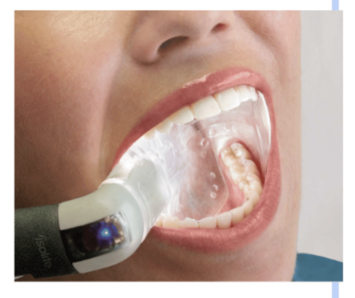 <p>Helpful when an assistant is not available</p><p>Easy to Use</p><p>Efficient</p><p>Works as a bite block</p><p>Multiple sizes</p><p>Can be used for both</p><p>maxillary and mandibular arches</p><p>Connects to your high volume</p><p>suction</p>