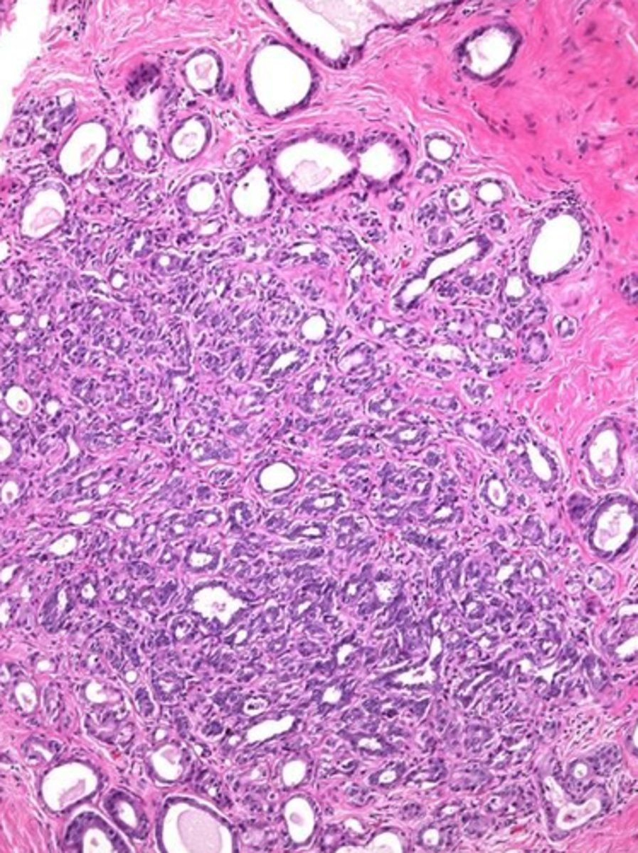 <p>smaller elongated ones</p>