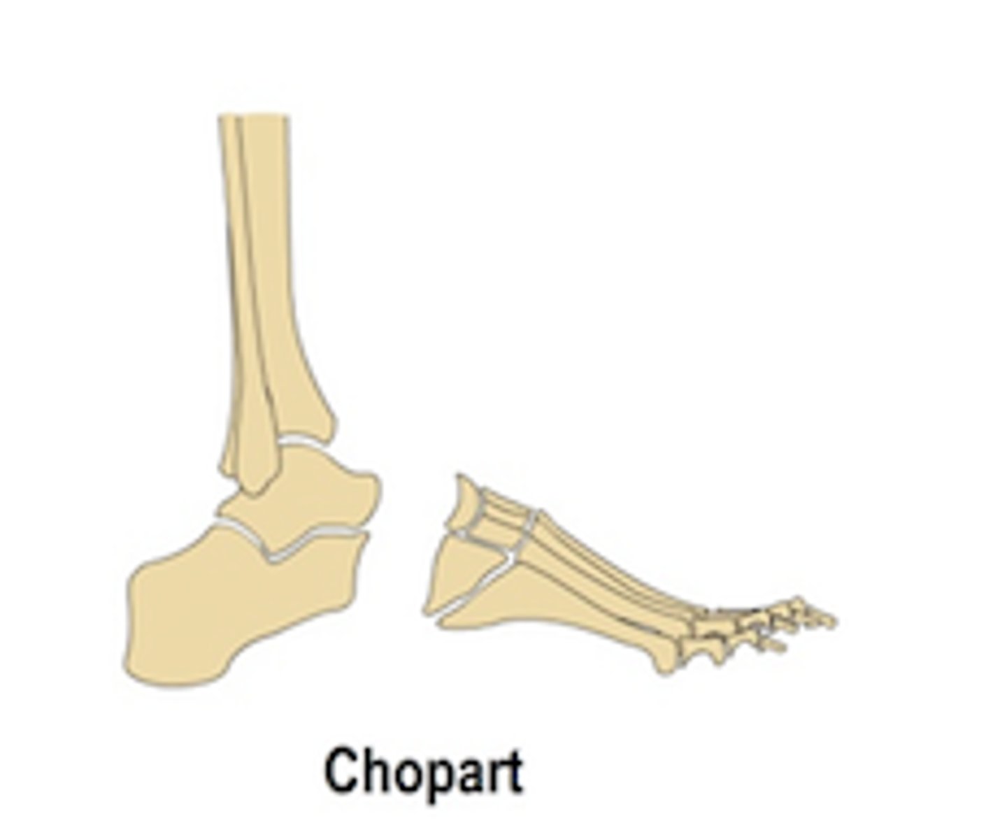 <p>Chopart</p>