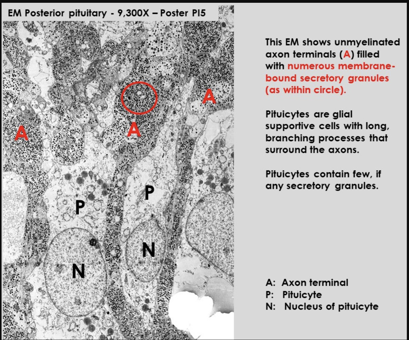 <ul><li><p>shows pituicytes and axons</p></li><li><p>notice:</p><ul><li><p>difference between number and secretory granules in each of them</p></li></ul></li><li><p>Posterior pit→ composed of non-myellinated axons of neurons located in <strong>hypothalamus</strong></p><ul><li><p>axons contain numerous secretory granules</p></li><li><p>supported by glial cells→ <strong>pituicytes</strong></p></li><li><p> numerous <strong>sinusoid</strong> capillaries present</p></li></ul></li></ul><p></p>