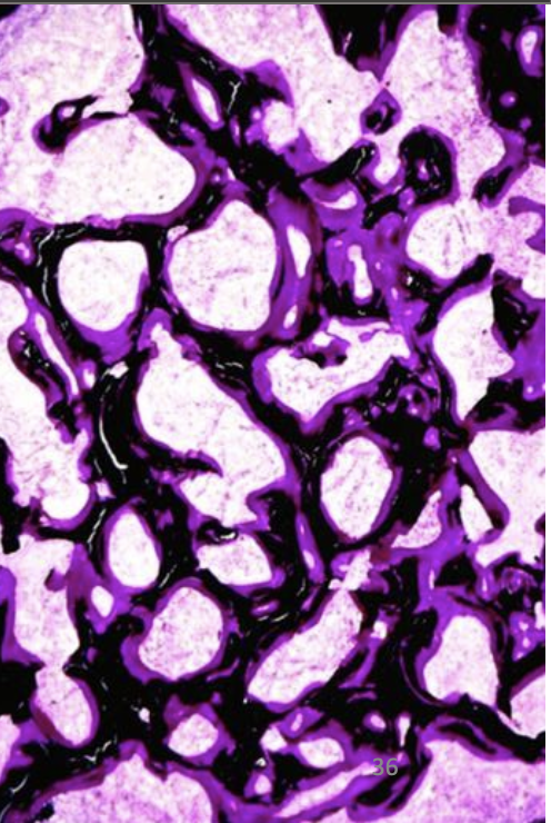 <p>What does this histo slide show?</p>