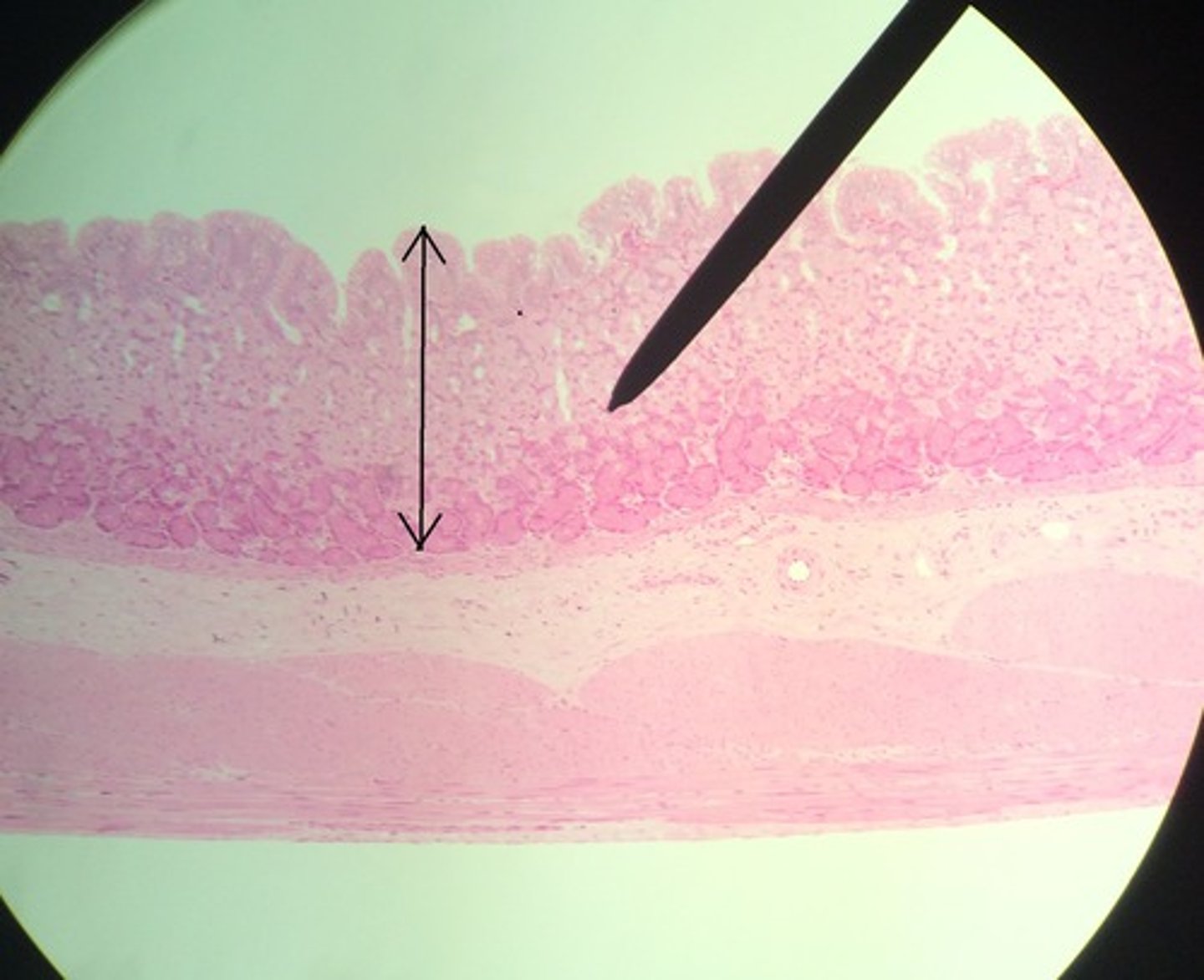<p>- folded into ridges called RUGAE (allows the stomach to expand after ingestion of food or liquid)</p><p>- the epithelium is simple columnar and inward folds extend down into the LAMINA PROPORIA to form GASTRIC GLANDS</p><p>- the epithelium secretes mucus to help protect the stomach from acids secreted by gastric glands (that help digest food)</p><p>LOOK AT PICTURE IN BOOK</p>