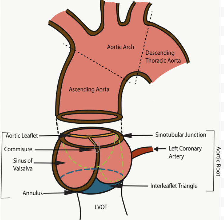 <p>Proximal segment of ascending aorta</p><ul><li><p>Include annulus, sinuses of Valsalva, sinotubular junction</p></li></ul><p></p>
