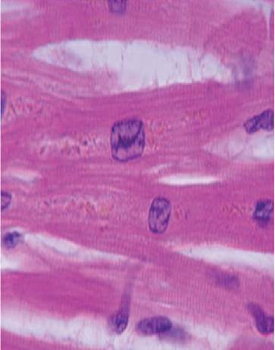 <p>Involuntary muscle tissue found only in the heart, striated</p>