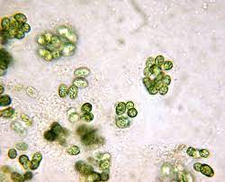 <p>what is this PROkaryotic cell? (<span style="font-family: Google Sans, Roboto, arial, sans-serif">Cyanobacteria)</span></p>