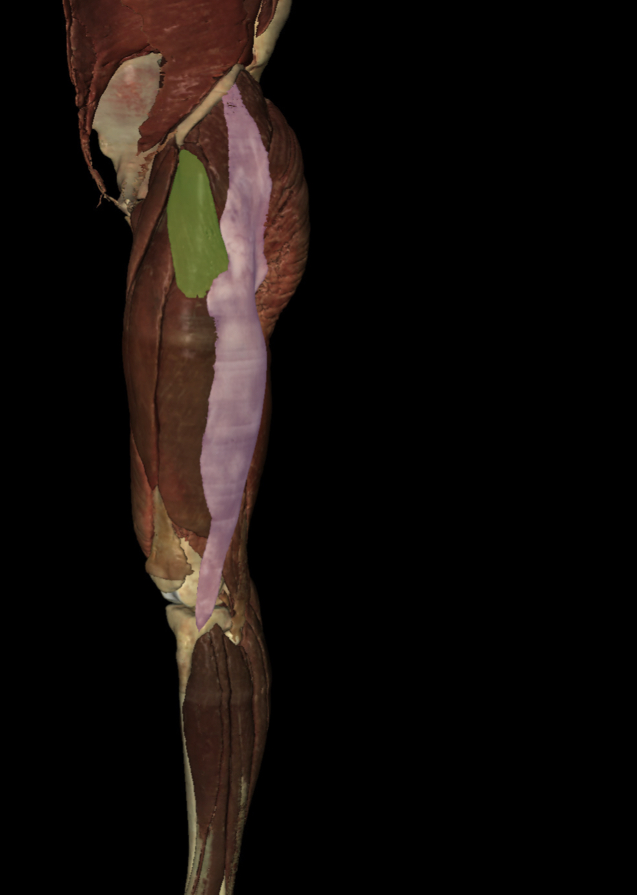 <p>Identify the Structure</p>