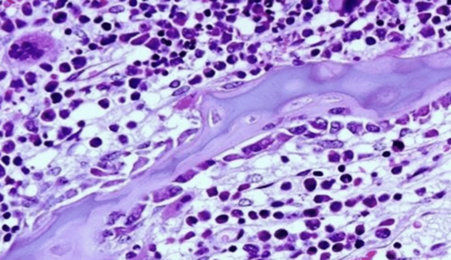 <p>what type of bone cell?</p>