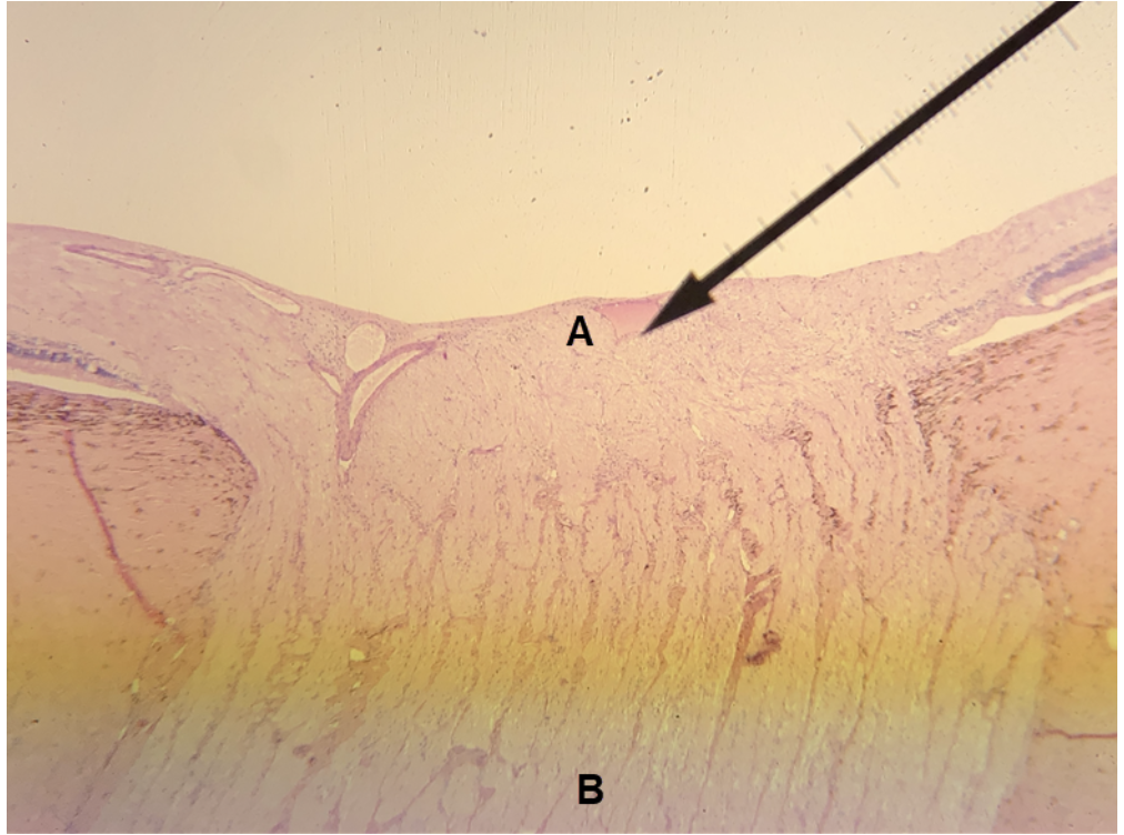 <p><span><span>In the image above, identify structures A and B.&nbsp;</span></span></p>